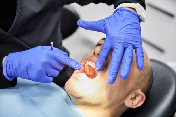 Best Chipped Tooth Repair Near Me  in Hartford, SD